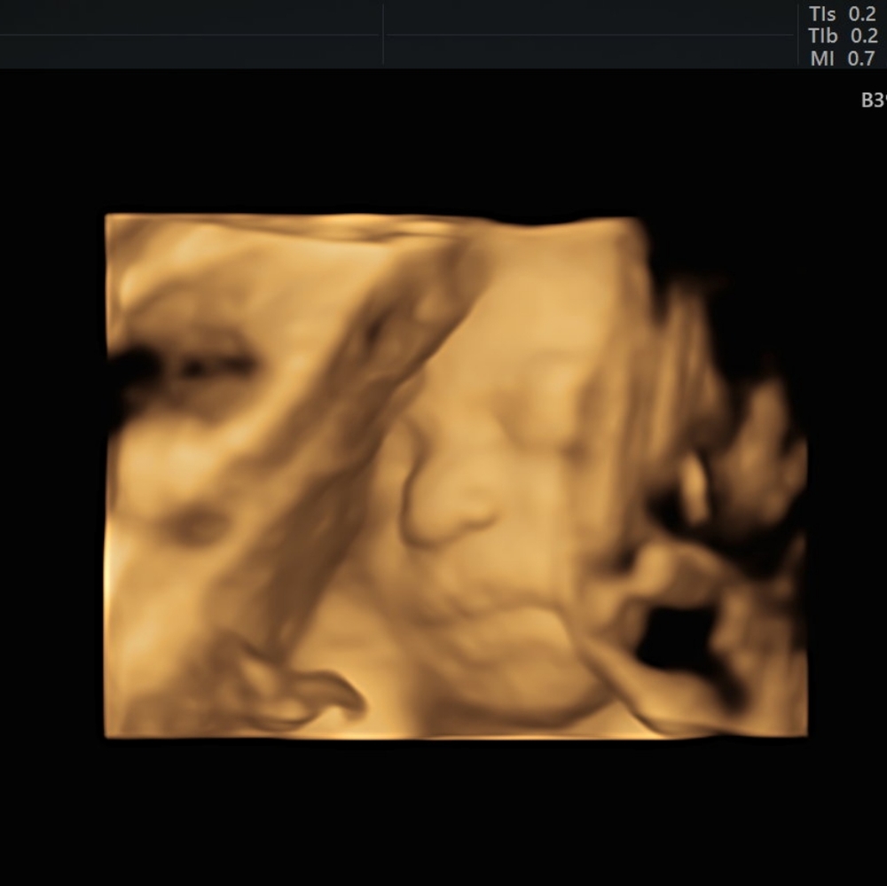 Close until after my baby comes
